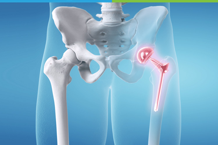 Orthopedics & Joint Replacement